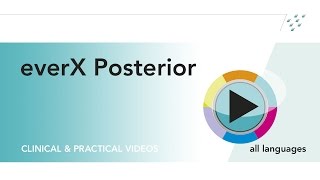 everX Posterior clinical video