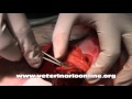 Operacion de un huron - Extirpacion del bazo - Esplenectomia - Veterinario Online