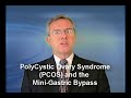 PolyCystic Ovary Syndrome (PCOS) and the Mini-Gastric Bypass