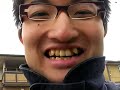 ????????????????????????#017