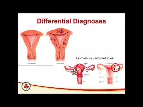 Early Diagnosis and Management of Endometriosis for Family Practice and Outpatient Gynecology Providers - Erin Unger, PA-C, CCPA