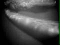Heart of a Soul Surfer - Trailer