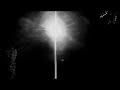 Son Coeur - Teaser 2