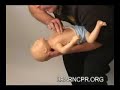 How To Help An Infant Who Is Choking