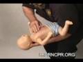How To Help An Infant Who Is Choking
