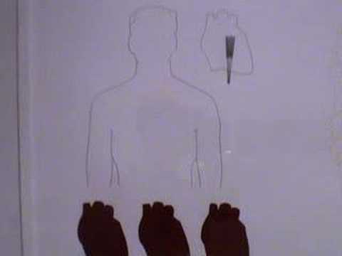 See video