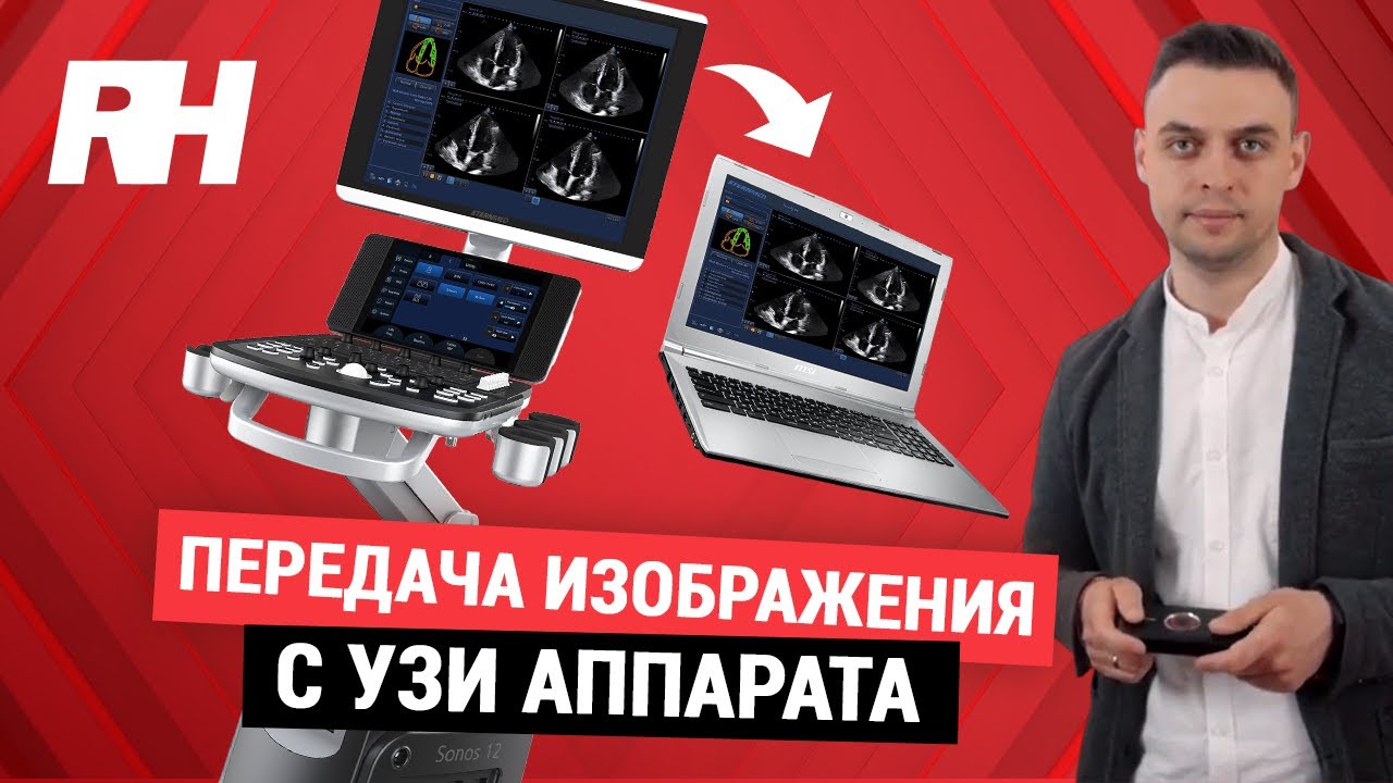 Передача изображения с УЗИ аппарата с помощью карты видеозахвата | Компания RH