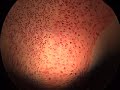 Anatomia patol�gica - Displasia