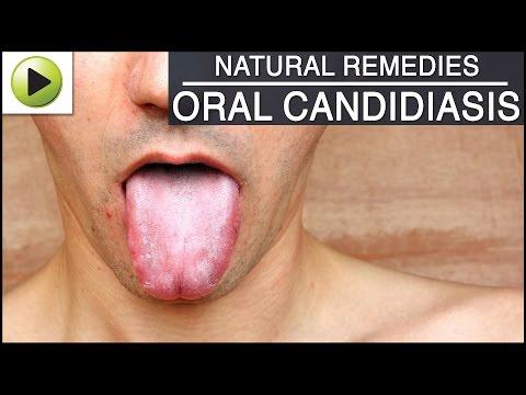 how to cure oral thrush