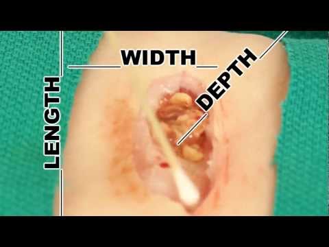 how to assess wound