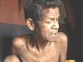 Cholera Epidemic in Orissa