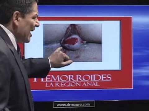 Orificio anal, I parte de II.