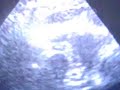 Echocardiography Echocardiography