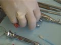 dentistry-horrors-wisdom-tooth-procedure-full.html