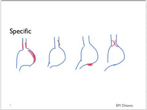 how to treat upper gi bleed