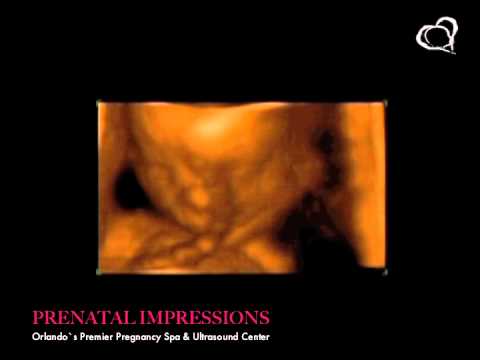 ultrasound 3d 4d - A 3D/4D Ultrasound taken of a baby that visited Prenatal Impressions, the only premier provider of 3D/4D Ultrasounds in Orlando, Florida since 2005. Prenatal...