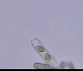 Two faces of a diatom: ??????? Two faces of a diatom: ???????