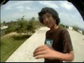 The downside of skateboarding