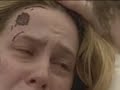 House MD: Fix you