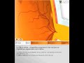 DMLA 3D: Quantel Medical
