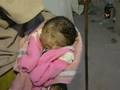 Baby-born-with-two-f