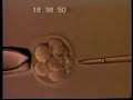 Embryo Biopsy Embryo Biopsy