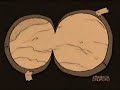 YoutubePoop:Magneto's buttocks part 3 I need an airsick bag.