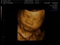 4D Scan 4D Scan