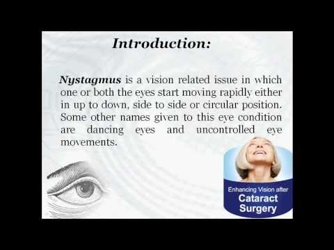 how to treat nystagmus