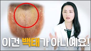 치아썜