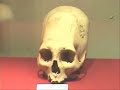 Trepanación craneal prehispánica en el Perú Trepanación craneal prehispánica en el Perú