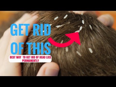 Remove Lice From Head With This Simple Safe And Natural Remedy