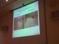 Dr. Joel M. Gottesfeld - part 3/4
