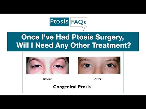 how to treat ptosis