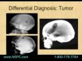 The Origins of Cranial Surgery, Ancient History of Neurosurgery (Part 2)