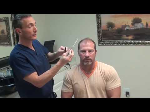 how to cover hair transplant scar