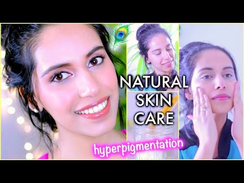 how to get rid hyperpigmentation caused by acne