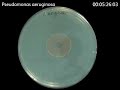 Pseudomonas aeruginosa - Zonex