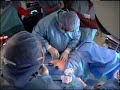 Minimally Invasive Hysterectomy