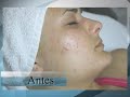 SOE SKIN REJUVENATIONS