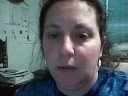 Spider Bites and Lupus...GROWL! Spider Bites and Lupus...GROWL!