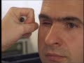 Artificial Eye - Eye Prosthesis - Glass Eye - Ocularist