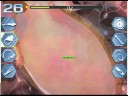 Trauma center under the knife 2 walkthrough operation 4