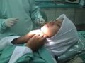Draping of Patient