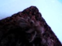 H.Hercules ?? dyskinetic syndrome ??