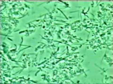 gencive - http://www.parodontite.com Image microscopique de vos microbes près de la gencive lorsque celle-ci est en santé. Bactéries peu mobiles en forme de points et ...