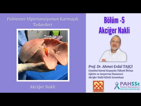 Pulmoner Hipertansiyonun Karmaşık Tedavileri - Bölüm -5- Akciğer Nakli - 2022.10.25