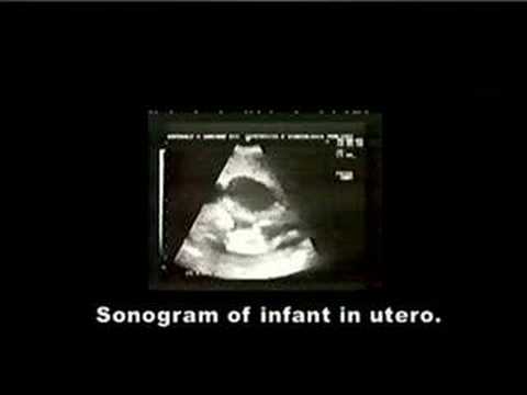 Cellular Echoes - Journey from Womb ...