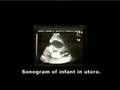 Cellular Echoes - Journey from Womb to the World