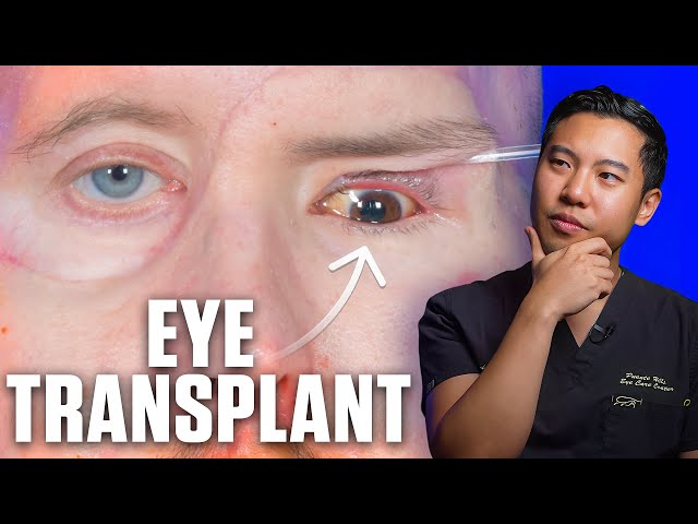 This man received the world’s FIRST eye transplant, but CAN HE SEE?